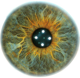 Iridology - Seeing is believing
